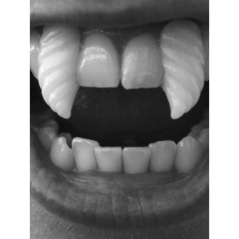 Spiral incisors