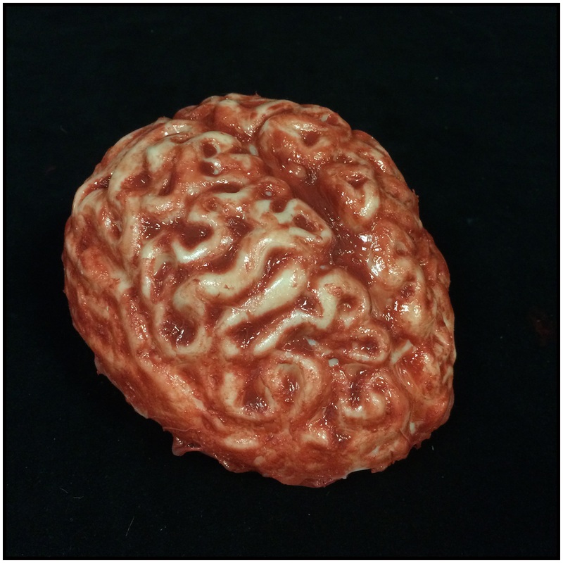Silicone Brain