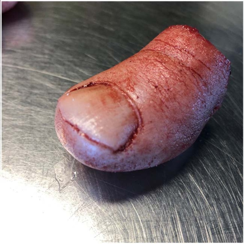 Silicone Severed Big Toe