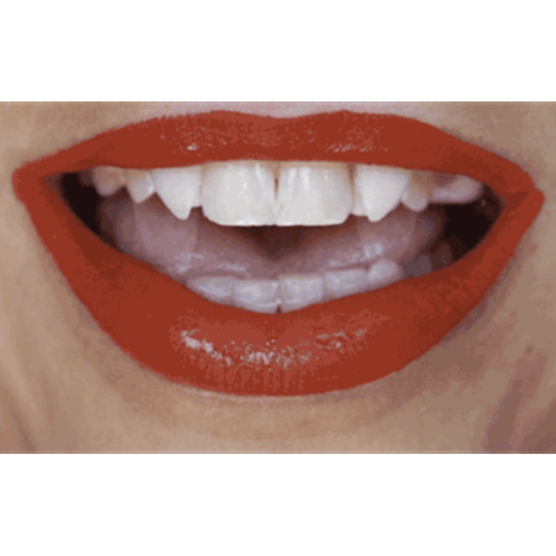 Default Down Retractable Fangs